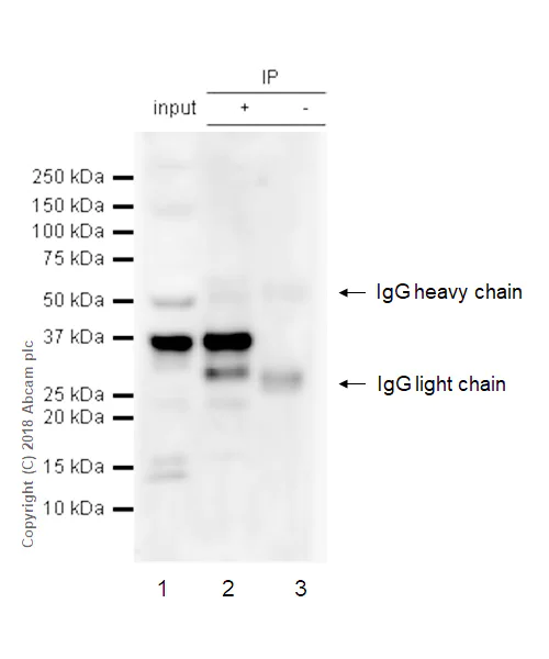 Immunoprecipitation - Anti-PIM2 antibody [EPR6987] - BSA and Azide free (AB240951)