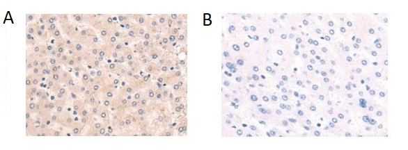 Immunohistochemistry (Formalin/PFA-fixed paraffin-embedded sections) - Anti-PIM3 antibody - C-terminal (AB198842)