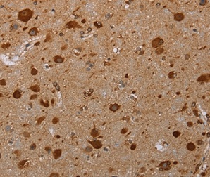Immunohistochemistry (Formalin/PFA-fixed paraffin-embedded sections) - Anti-PIM3 antibody - C-terminal (AB198842)