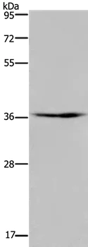 Western blot - Anti-PIM3 antibody - C-terminal (AB198842)