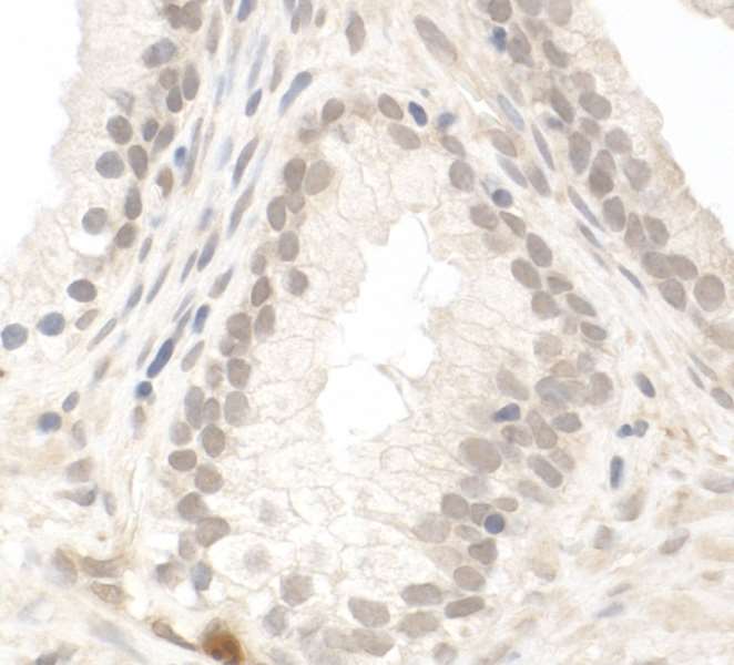 Immunohistochemistry (Formalin/PFA-fixed paraffin-embedded sections) - Anti-PIMT antibody (AB70559)