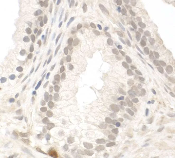 Immunohistochemistry (Formalin/PFA-fixed paraffin-embedded sections) - Anti-PIMT antibody (AB70559)