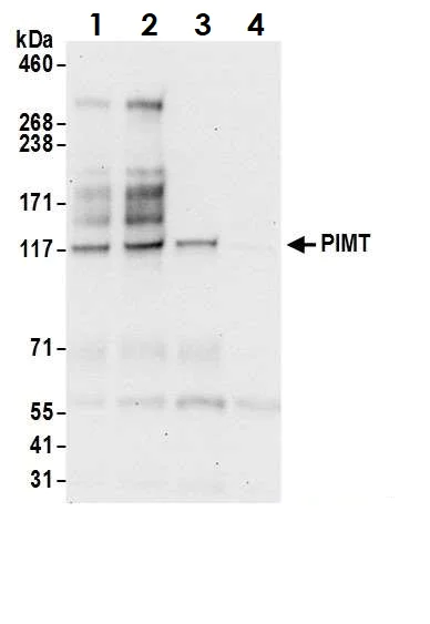 Immunoprecipitation - Anti-PIMT antibody (AB70559)
