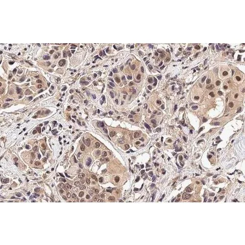 Immunohistochemistry (Formalin/PFA-fixed paraffin-embedded sections) - Anti-PIN1 antibody [HL2480] (AB317235)