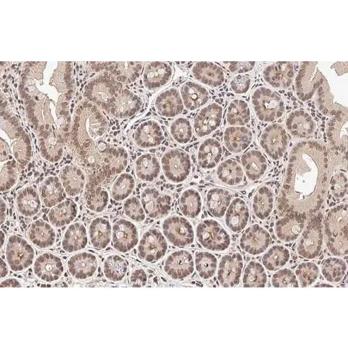 Immunohistochemistry (Formalin/PFA-fixed paraffin-embedded sections) - Anti-PIN1 antibody [HL2480] (AB317235)