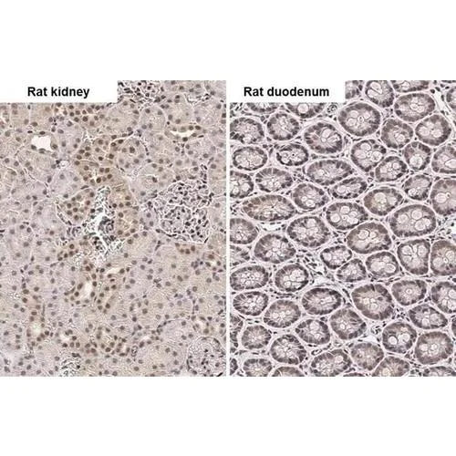 Immunohistochemistry (Formalin/PFA-fixed paraffin-embedded sections) - Anti-PIN1 antibody [HL2480] (AB317235)