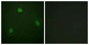 Immunocytochemistry/ Immunofluorescence - Anti-Pin1 antibody - N-terminal (AB189321)