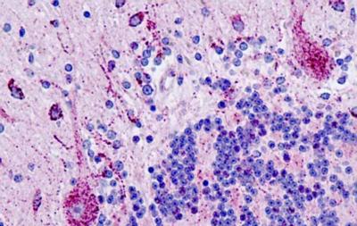 Immunohistochemistry (Formalin/PFA-fixed paraffin-embedded sections) - Anti-Pin1 antibody - N-terminal (AB189321)