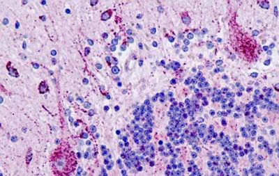 Immunohistochemistry (Formalin/PFA-fixed paraffin-embedded sections) - Anti-Pin1 antibody - N-terminal (AB189321)