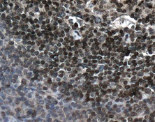 Immunohistochemistry (Formalin/PFA-fixed paraffin-embedded sections) - Anti-PIN4 antibody [EPR10033] (AB155283), expandable thumbnail