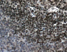 Immunohistochemistry (Formalin/PFA-fixed paraffin-embedded sections) - Anti-PIN4 antibody [EPR10033] (AB155283)
