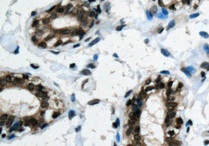 Immunohistochemistry (Formalin/PFA-fixed paraffin-embedded sections) - Anti-PIN4 antibody [EPR10033] (AB155283), expandable thumbnail
