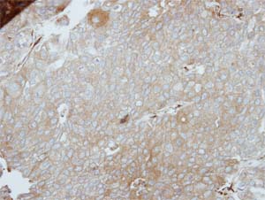 Immunohistochemistry (Formalin/PFA-fixed paraffin-embedded sections) - Anti-PINCH 1 antibody (AB154331), expandable thumbnail