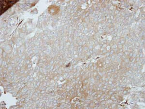Immunohistochemistry (Formalin/PFA-fixed paraffin-embedded sections) - Anti-PINCH 1 antibody (AB154331)