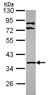 Western blot - Anti-PINCH 1 antibody (AB154331)