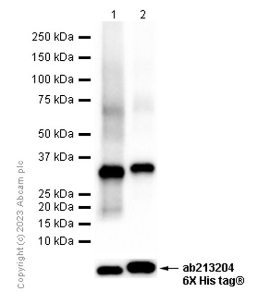 Western blot - Anti-PINCH 1 + PINCH 2 antibody [EP1943Y] (AB76112), expandable thumbnail