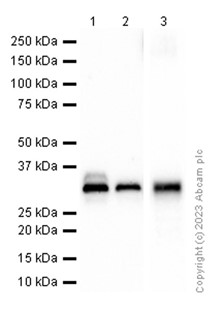 Western blot - Anti-PINCH 1 + PINCH 2 antibody [EP1943Y] (AB76112), expandable thumbnail