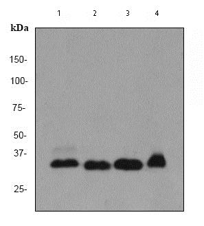 Western blot - Anti-PINCH 1 + PINCH 2 antibody [EP1943Y] (AB76112), expandable thumbnail