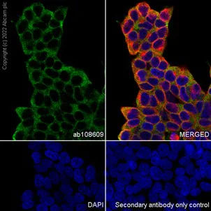 Immunocytochemistry/ Immunofluorescence - Anti-PINCH 1 + PINCH 2 antibody [EP1944] (AB108609)