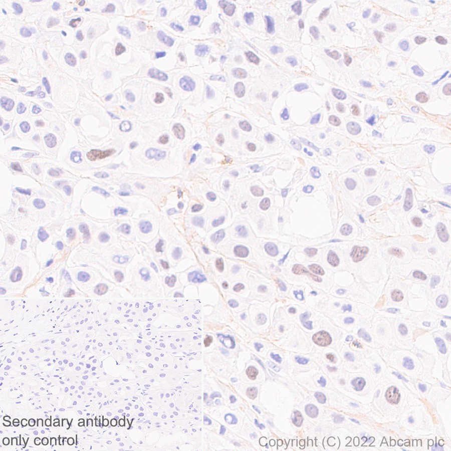 Immunohistochemistry (Formalin/PFA-fixed paraffin-embedded sections) - Anti-PINCH 1 + PINCH 2 antibody [EP1944] (AB108609), expandable thumbnail