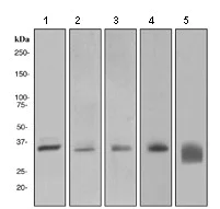Western blot - Anti-PINCH 1 + PINCH 2 antibody [EP1944] (AB108609)