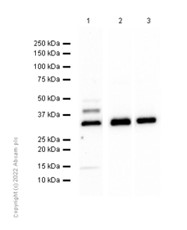 Western blot - Anti-PINCH 1 + PINCH 2 antibody [EP1944] (AB108609), expandable thumbnail