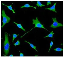 Immunocytochemistry/ Immunofluorescence - Anti-PINCH 1 + PINCH 2 antibody [EP1944] - BSA and Azide free (AB284780)