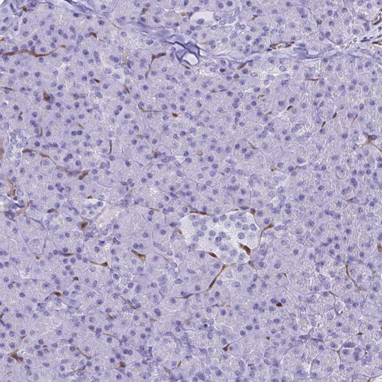 Immunohistochemistry (Formalin/PFA-fixed paraffin-embedded sections) - Anti-PINCH-2 antibody (AB272666)