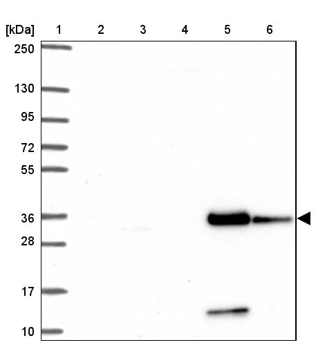 Western blot - Anti-PINCH-2 antibody (AB272666)