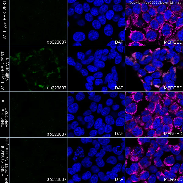 Immunocytochemistry/ Immunofluorescence - Anti-PINK1 antibody [EPR29146-340] - BSA and Azide free (AB324111)