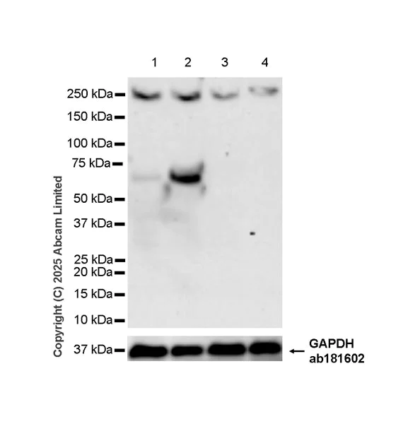 Western blot - Anti-PINK1 antibody [EPR29146-340] - BSA and Azide free (AB324111)