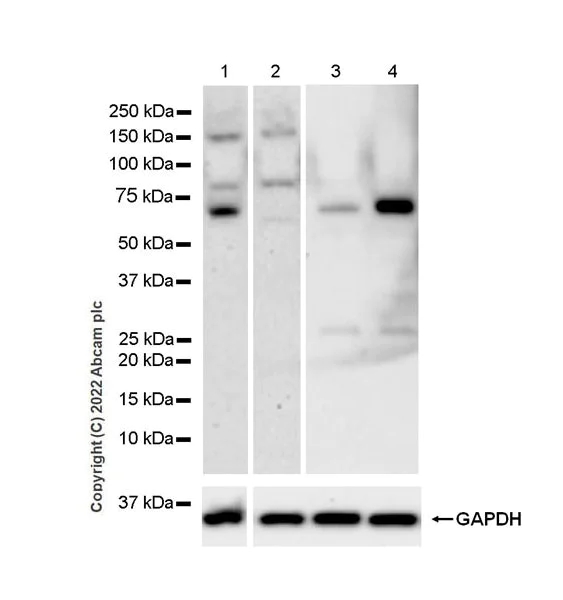 Western blot - Anti-PINK1 antibody [MJF-R32-7] - BSA and Azide free (AB300624)