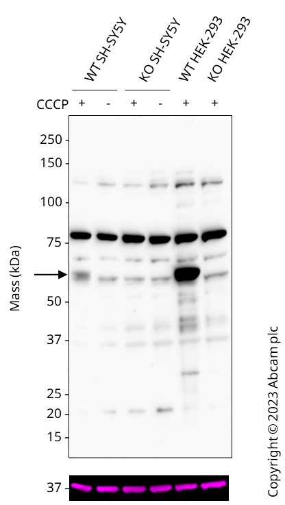 Western blot - Anti-PINK1 antibody [MJF-R32-7] - BSA and Azide free (AB300624), expandable thumbnail