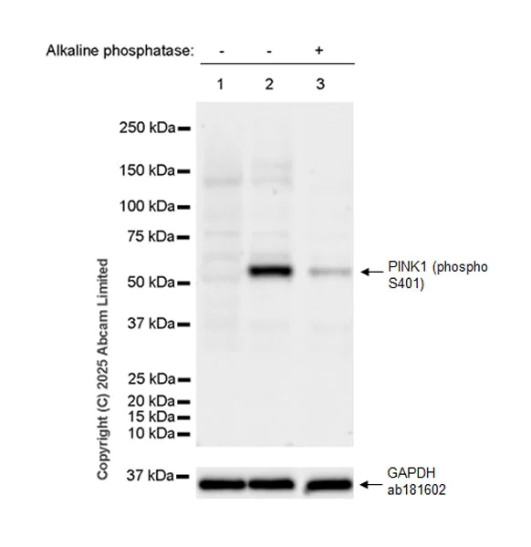 Western blot - Anti-PINK1 (phospho S401) antibody [EPR26308-532] (AB324681)