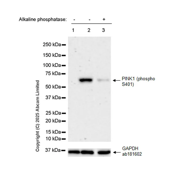 Western blot - Anti-PINK1 (phospho S401) antibody [EPR26308-532] - BSA and Azide free (AB326589)