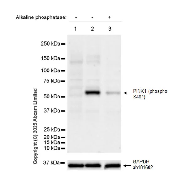 Western blot - Anti-PINK1 (phospho S401) antibody [EPR26308-532] - BSA and Azide free (AB326589)