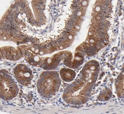 Immunohistochemistry (Formalin/PFA-fixed paraffin-embedded sections) - Anti-Pinkbar antibody (AB224323), expandable thumbnail