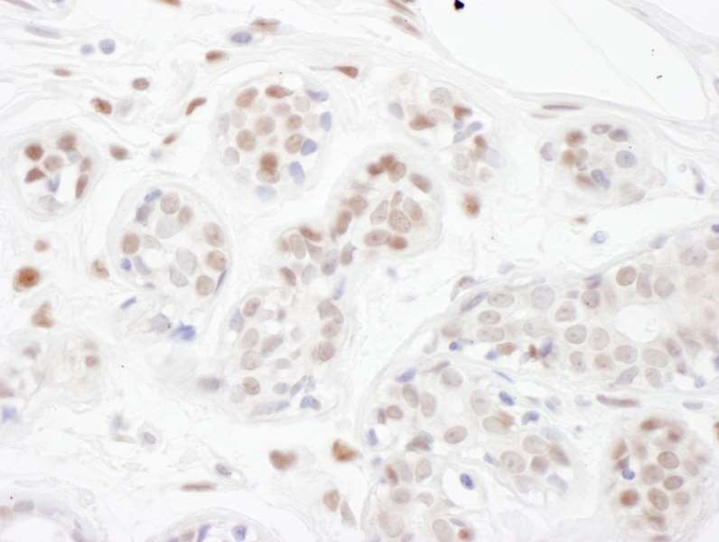 Immunohistochemistry (Formalin/PFA-fixed paraffin-embedded sections) - Anti-PINX1/LPTS antibody (AB190252), expandable thumbnail