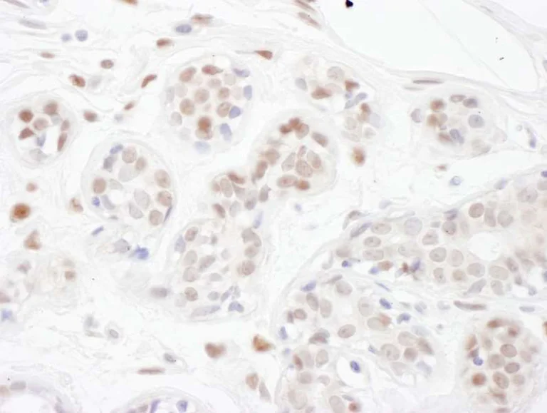 Immunohistochemistry (Formalin/PFA-fixed paraffin-embedded sections) - Anti-PINX1/LPTS antibody (AB190252)