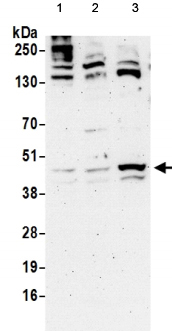 Western blot - Anti-PINX1/LPTS antibody (AB190252), expandable thumbnail