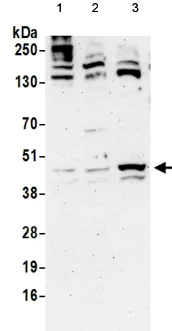 Western blot - Anti-PINX1/LPTS antibody (AB190252)