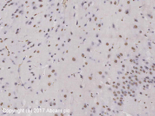 Immunohistochemistry (Formalin/PFA-fixed paraffin-embedded sections) - Anti-PIP2 antibody [2C11] (AB11039)