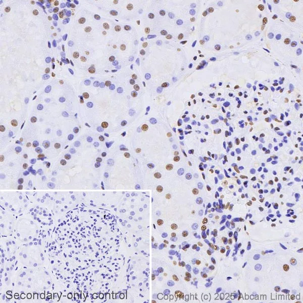 Immunohistochemistry (Formalin/PFA-fixed paraffin-embedded sections) - Anti-PIP2 antibody [2C11] (AB11039)