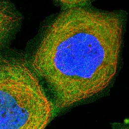 Immunocytochemistry/ Immunofluorescence - Anti-PIP5K1 alpha/PIP5K1A antibody (AB122049)