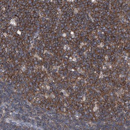 Immunohistochemistry (Formalin/PFA-fixed paraffin-embedded sections) - Anti-PIP5K1 alpha/PIP5K1A antibody (AB122049), expandable thumbnail