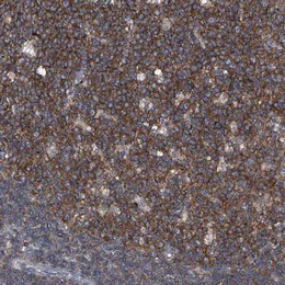 Immunohistochemistry (Formalin/PFA-fixed paraffin-embedded sections) - Anti-PIP5K1 alpha/PIP5K1A antibody (AB122049)