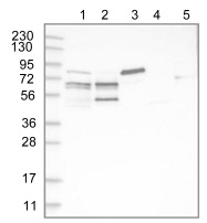 Western blot - Anti-PIP5K1 alpha/PIP5K1A antibody (AB122049), expandable thumbnail