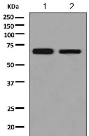 Western blot - Anti-PIP5K1 beta antibody [EPR9268] (AB154818)