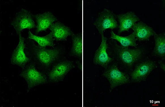 Immunocytochemistry/ Immunofluorescence - Anti-PIP5K1A antibody [HL2011] (AB308218)
