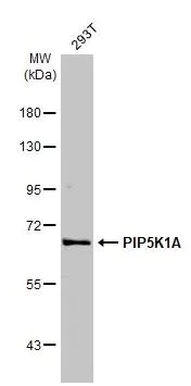 Western blot - Anti-PIP5K1A antibody [HL2011] (AB308218)